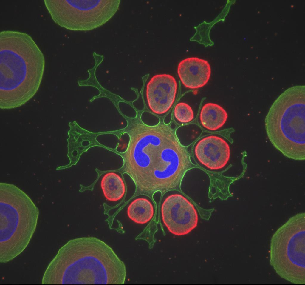 Immagine al microscopio a fluorescenza di cellule con nuclei colorati di blu e strutture contrassegnate in rosso e verde – Illustrazione relativa alla ricerca sull’apoptosi nella radice del dente di leone